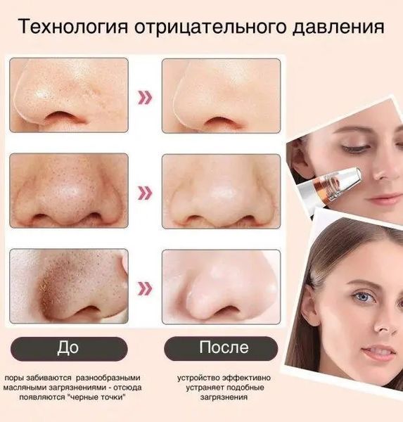 Вакуумний очищувач шкіри та пор Multi-Functional для чищення обличчя 41530 фото